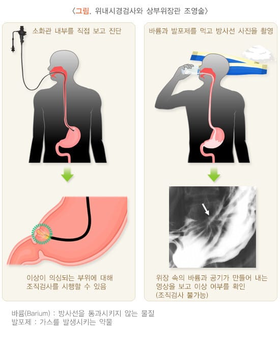 국가암검진 프로그램 > 위 