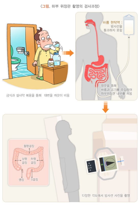 국가암검진 프로그램 > 대장